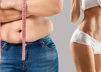 Obezite Nasıl Önlenir? Obeziteyi Önlemek Mümkün müdür?