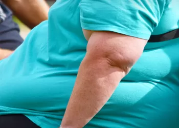 Obezite Nedir? Nedenleri Nelerdir?