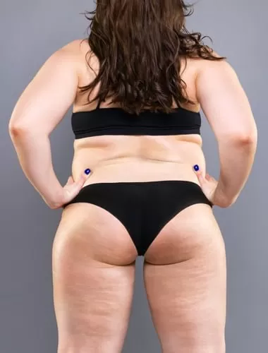 Unlu Diyetisyenler Isimleri